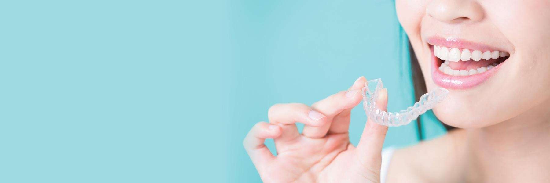 SureSmile® Clear Aligners | Dentist